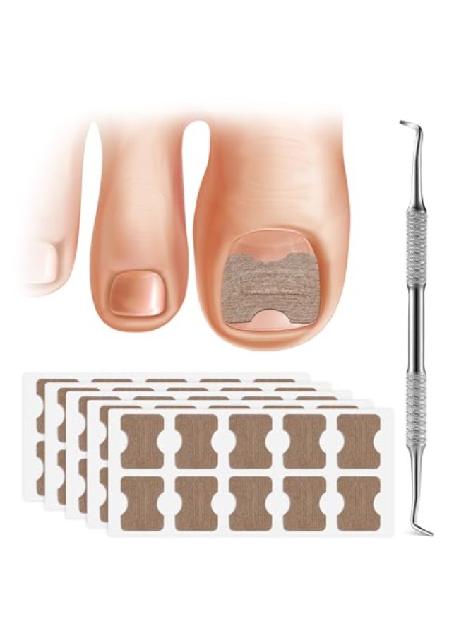 FERYES 50 PCS Breathable Ingrown Toenail Corrector Patch with DoubleEnded Stainless Steel Toenail Lifter Comprehensive Toenail Care Solution - Image 1