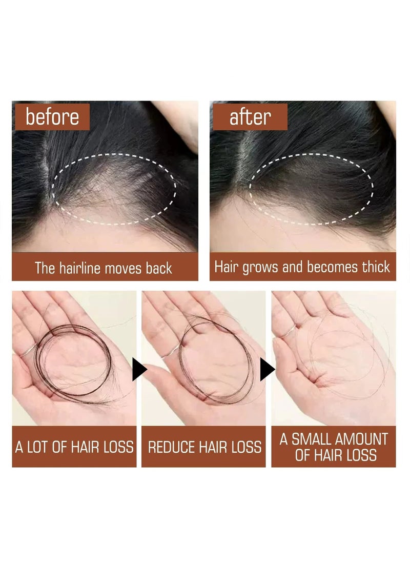 EELHOE - Batana Oil for Revitalized Hair Growth & Strength 100% Unrefined Thickens Fuller Healthier Hair, Organic Hair Treatment 120ml/4.05fl.oz - Image 1