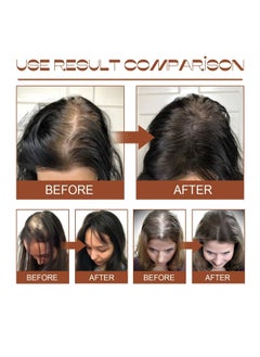 EELHOE Batana Oil for Revitalized Hair Growth & Strength 100% Unrefined Thickens Fuller Healthier Hair, Organic Hair Treatment 120ml/4.05fl.oz  - Image 2