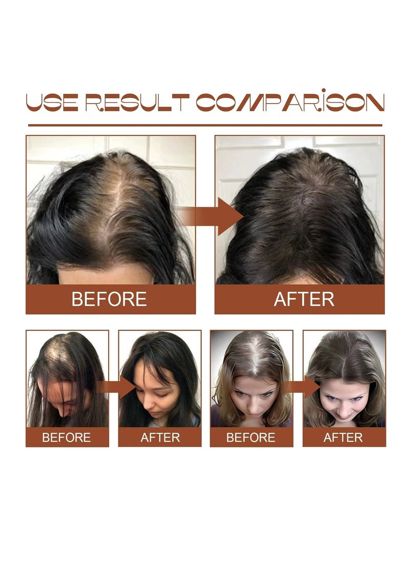 EELHOE - Batana Oil for Revitalized Hair Growth & Strength 100% Unrefined Thickens Fuller Healthier Hair, Organic Hair Treatment 120ml/4.05fl.oz - Image 1