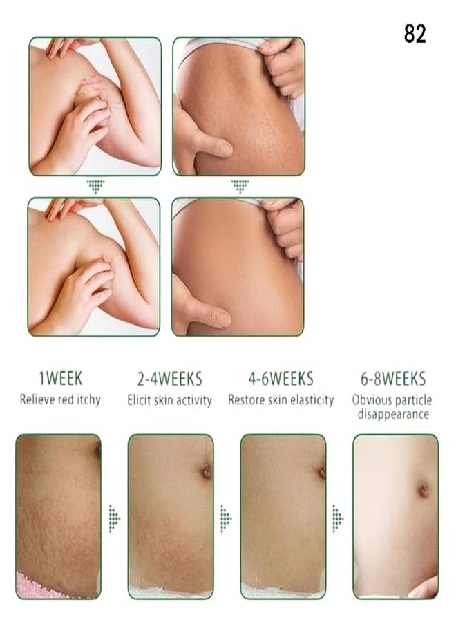 Zero Pathy ZeroPathy 35ml Stretch Mark & Scar Healing Lotion FACE CREAM- Ayurvedic Repair for Burn Spots, Pimple Scars, Skin Pigmentation - No Harmful Chemicals - Image 5