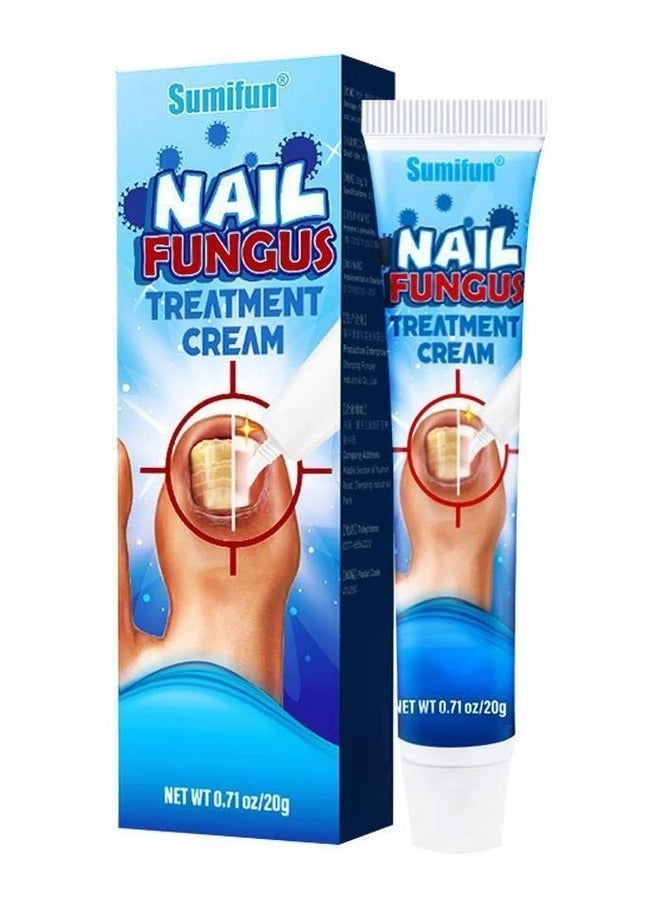 سوميفون كريم علاج فطريات الأظافر يعزز نمو الأظافر ويحسن مظهر الأظافر المتقدمة في السن، عناية مغذية بالأظافر وتخفيف آلام الأظافر، كريم إصلاح الأظافر 20 جرام - Image 1