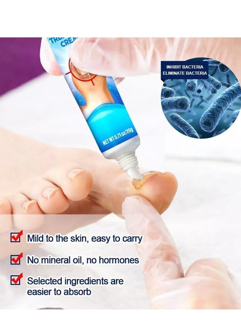 سوميفون كريم علاج فطريات الأظافر يعزز نمو الأظافر ويحسن مظهر الأظافر المتقدمة في السن، عناية مغذية بالأظافر وتخفيف آلام الأظافر، كريم إصلاح الأظافر 20 جرام - Image 2