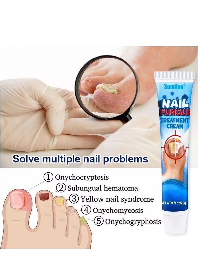 سوميفون كريم علاج فطريات الأظافر يعزز نمو الأظافر ويحسن مظهر الأظافر المتقدمة في السن، عناية مغذية بالأظافر وتخفيف آلام الأظافر، كريم إصلاح الأظافر 20 جرام - Image 4