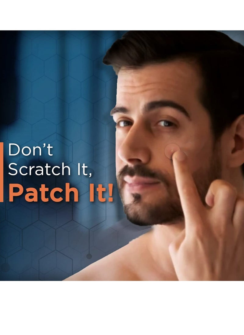 BEARDHOOD - Acne Pimple Patch 72 Hydrocolloid Waterproof Patches For Active Surface Acne Absorbs Pimple Overnight Reduces Excess Oil | For All Skin Types - Image 1