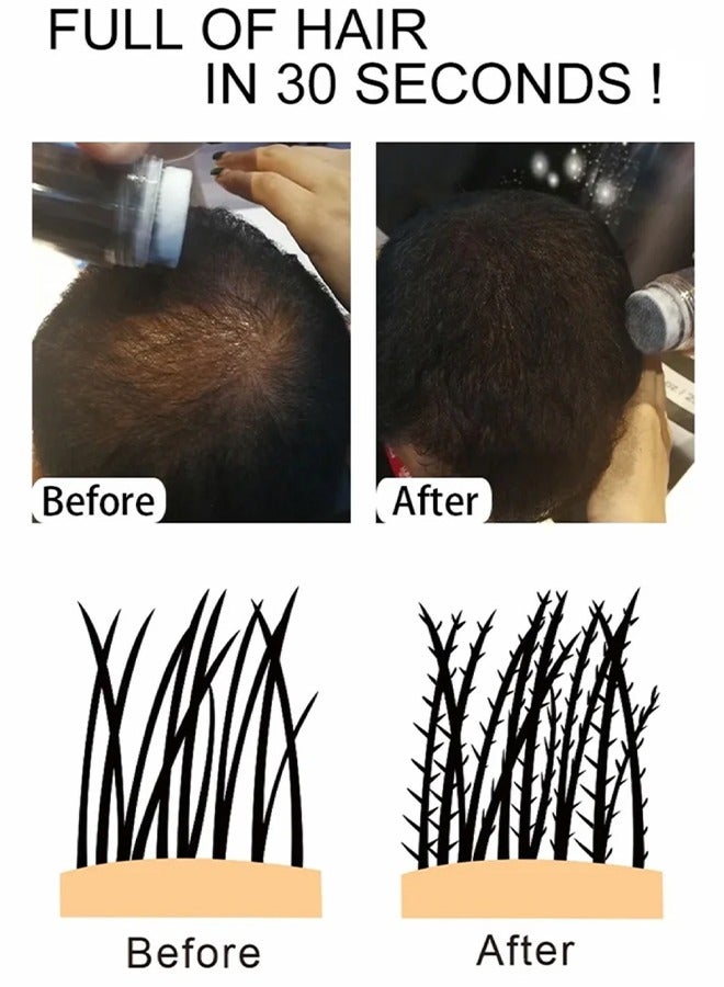 EELHOE Hair Building Fibers- 5 Seconds Cover Hair Loss , Keratin Thicker Anti Hairs Loss Concealer Thickening Fiber Powders Growth , Conceals Hair Loss And Look Younger - Image 3