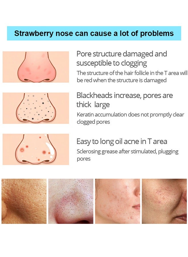 Vibrant Glamour Blackhead Remover Mask, Peel Off Face Mask, Charcoal Peel Off Black Mask, Deep Cleansing For Face Nose Blackhead Pores Acne, Facial Purifying And Clean Blackhead 30G - Image 5