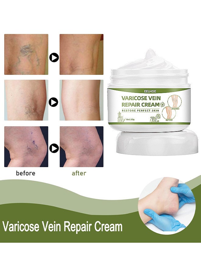 EELHOE Varicose Veins Repair Cream, Spider Veins Repair Cream, Strengthen Capillary Health, Varicose Vein Treatment Cream For Legs, Improve Blood Circulation, Tired And Heavy Legs 50G - Image 5