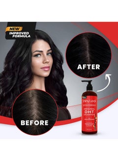 Shiny Leaf Anti-Hair Loss Shampoo With Biotin, for Men & Women - Sulfate-Free, Natural DHT Blocking Formula for Hair Growth, Thinning Hair Prevention, 16 Oz  - Image 5