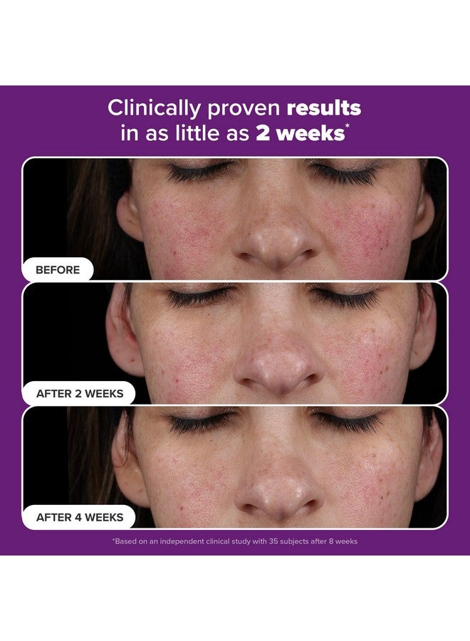 PAULA'S CHOICE Paula’s Choice Pro Retinaldehyde Dual-Retinoid Advanced Treatment, High Potency Anti-Aging Serum for Breakout-Prone Skin, Radiance & Rough, Bumpy Texture, Fragrance-Free, 1 Fl. Oz. - Image 3