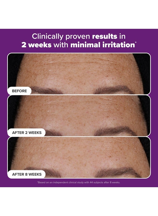 PAULA'S CHOICE Paula’s Choice Pro Retinaldehyde Dual-Retinoid Advanced Treatment, High Potency Anti-Aging Serum for Breakout-Prone Skin, Radiance & Rough, Bumpy Texture, Fragrance-Free, 1 Fl. Oz. - Image 4