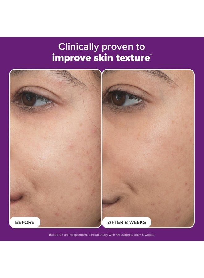 PAULA'S CHOICE Paula’s Choice Pro Retinaldehyde Dual-Retinoid Advanced Treatment, High Potency Anti-Aging Serum for Breakout-Prone Skin, Radiance & Rough, Bumpy Texture, Fragrance-Free, 1 Fl. Oz. - Image 5