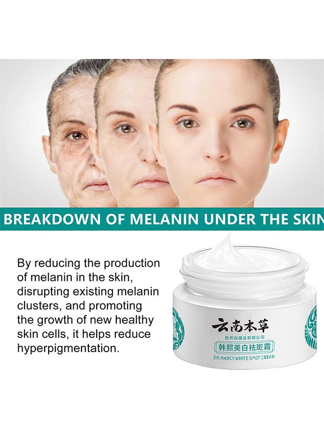 Hancy Freckle Whitening Cream To Remove Dark Spots And Melasma Remover, Dark Spot Corrector, Yunnan Herbal Freckle-Removing Cream, 20G - Image 4
