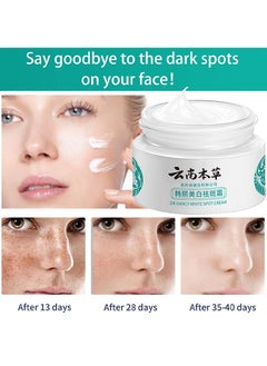 Hancy Freckle Whitening Cream To Remove Dark Spots And Melasma Remover, Dark Spot Corrector, Yunnan Herbal Freckle-Removing Cream, 20G  - Image 5