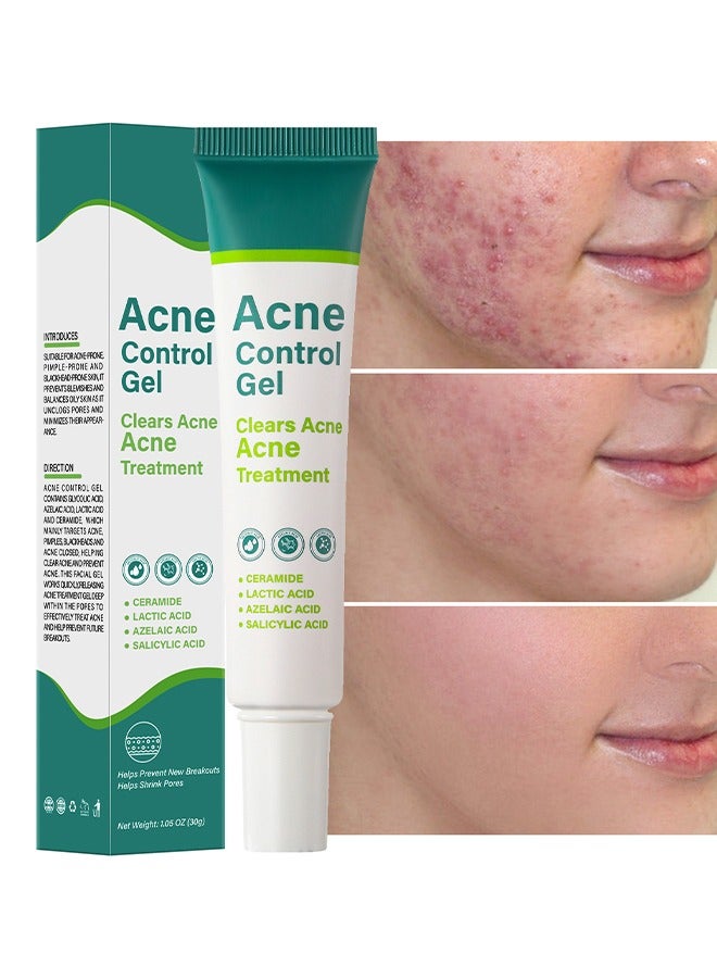 Acne Control Gel-Salicylic Acid Remove Acne Gel Lighten Acne Marks Remove Acne Shrink Pores Plant Essence - Fast Acne Removal in 12 Hours to See Results