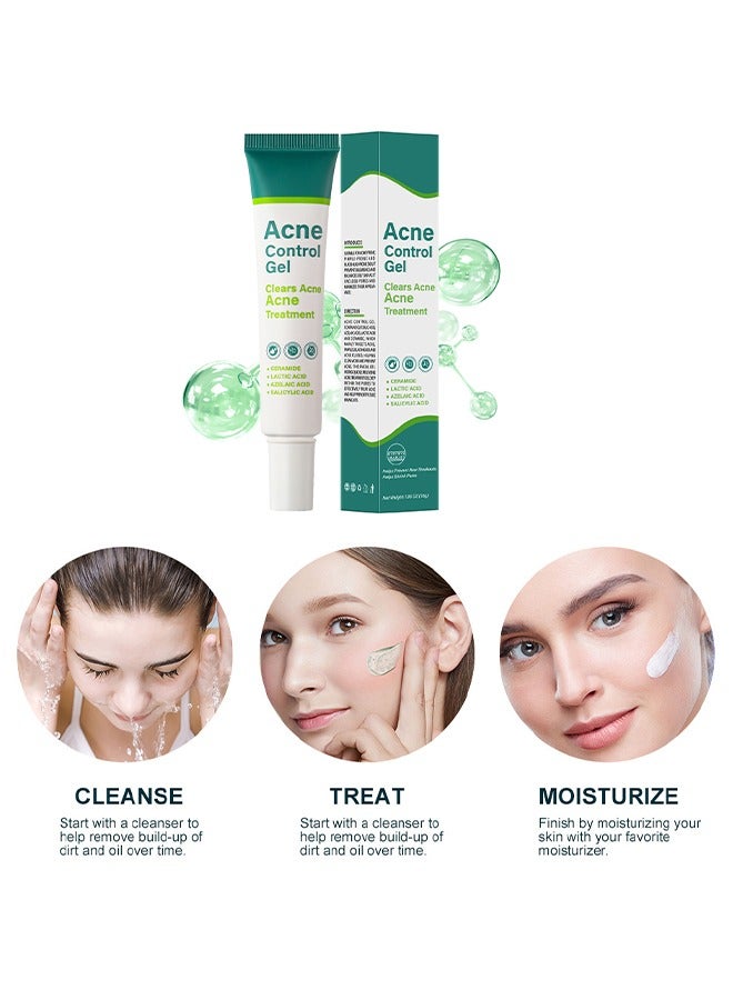 Acne Control Gel-Salicylic Acid Remove Acne Gel Lighten Acne Marks Remove Acne Shrink Pores Plant Essence - Fast Acne Removal in 12 Hours to See Results