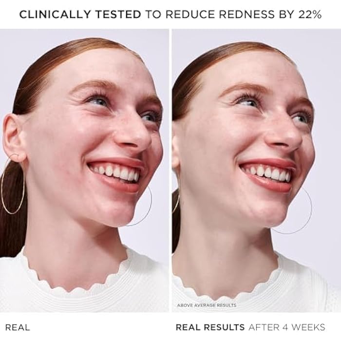 IT Cosmetics Bye Bye Redness Serum - Skin-Calming & Hydrating Face Serum - Instantly Neutralizes Facial Redness - 1% Colloidal Oatmeal, Centella, Peptide & Niacinamide – All Skin Types - 1 fl oz - Image 3