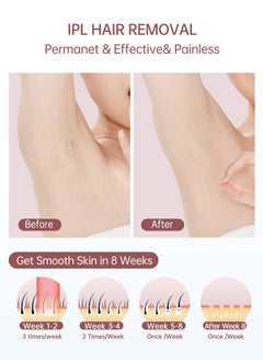 JOOYEE IPL Hair Removal Device Ice Cooling Function for Painless Hair Removal with 999900 Flashes Auto and Manual Mode  - Image 3