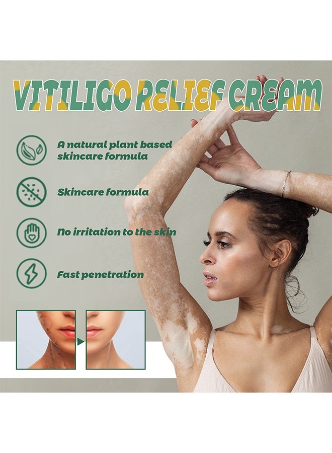 سوميفون كريم تخفيف البهاق ، علاج مرهم البهاق للبشرة ، يتلاشى البقع البيضاء ويحسن كريم تصبغ البشرة ، كريم البهاق للعناية الصحية بالبشرة 20 جرام - Image 4