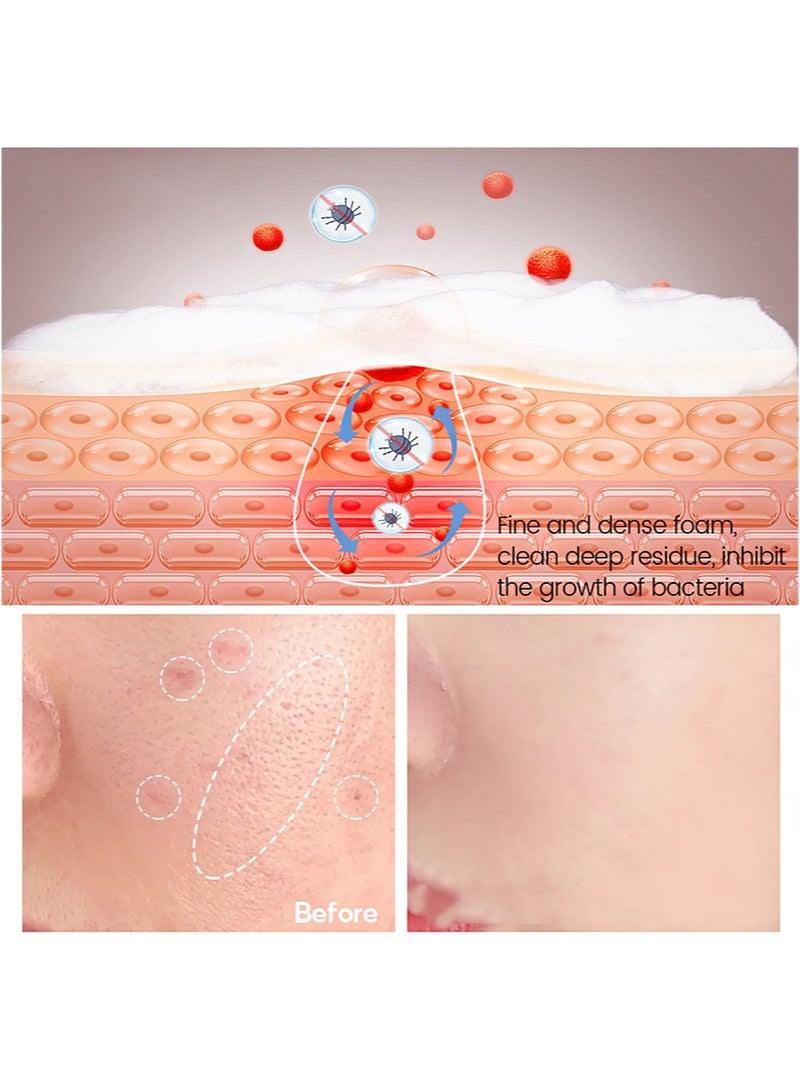 Vibrant Glamour Salicylic Acidacne Soap，Pore Exfoliating Softening Skin Face Deep Cleansing Body Wash Bath Soap Salicylic Acid Acne Treatment Soap - Image 3