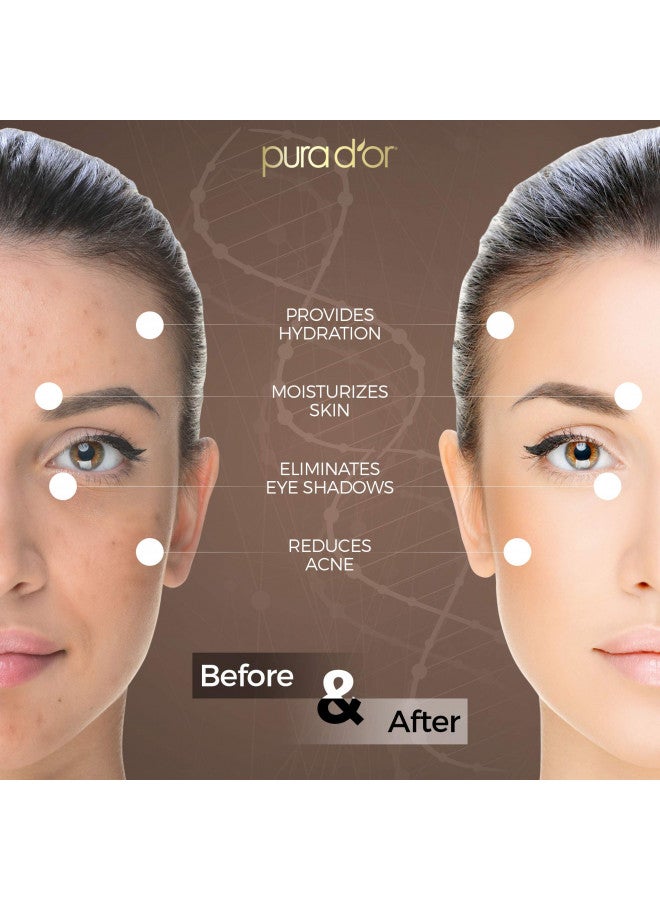 Pura d'or PURA D'OR Organic Tamanu Oil, USDA Certified 100% Pure & Natural Carrier Oil, Hexane Free Premium Grade Moisturizer Helps Reduce Appearance of Scars from Psoriasis, Eczema & Acne For Men & Women, 4oz - Image 5