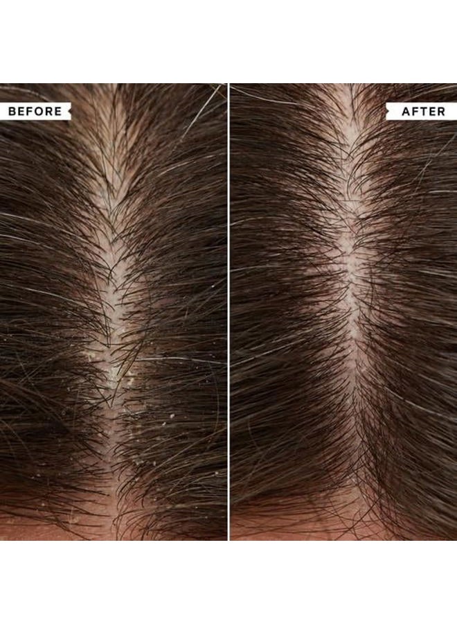 Philip Kingsley Conditioner for Flaky Scalp, 6.76 fl oz - Hydrating, Nourishing, Moisturizing, Detangles, Moisturizes Dry Hair, Suitable for Oily and Dry Scalps, Paraben Free, Vegan - Image 5