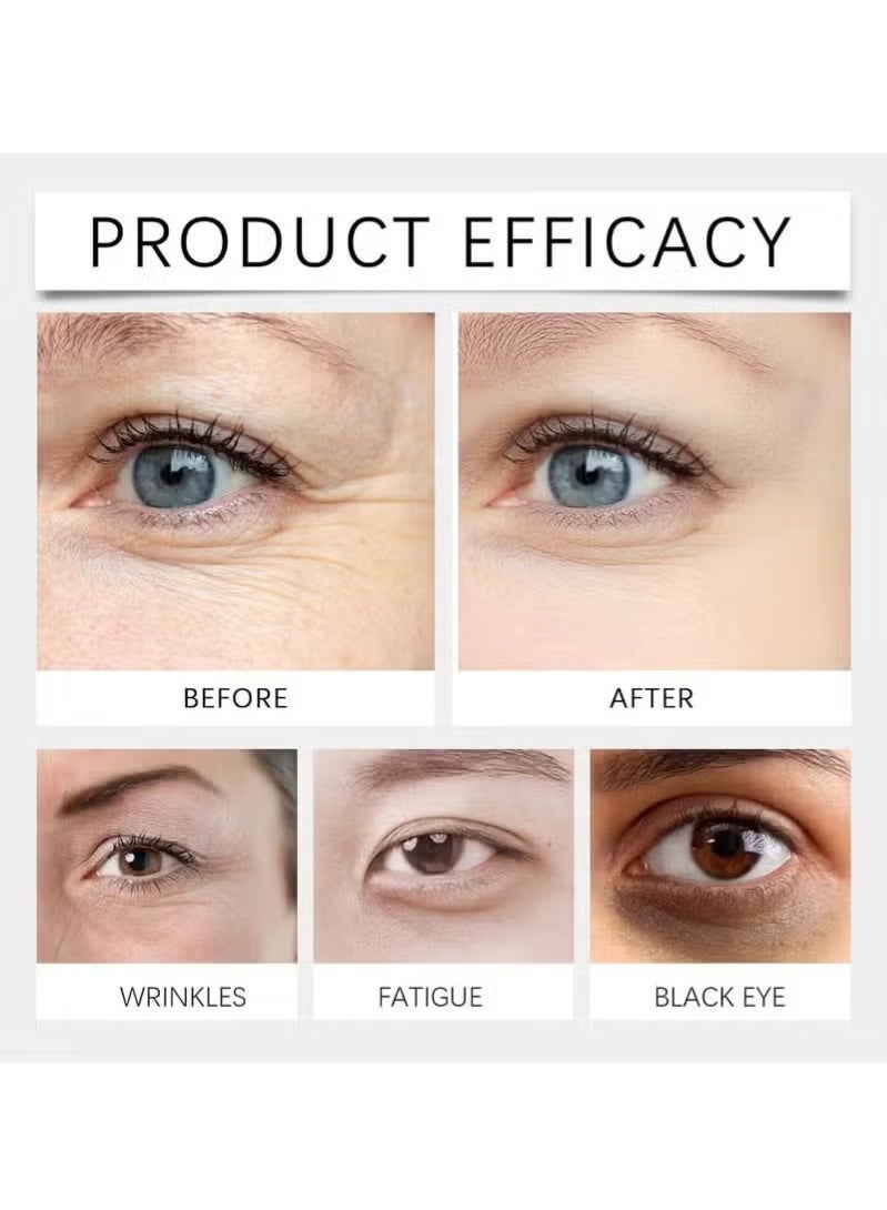 OUHOE Rollerball Castor Oil Anti-Wrinkle Eye Serum, Castor Oil and Frankincense Eye Roller, Firming Eye Cream for Dark Circles, Puffy Eyes, Eye Bags, and Anti-Aging Treatment - Image 5