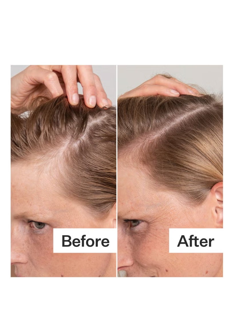 Act+Acre Cold Processed Scalp Renew 60ml - Image 3