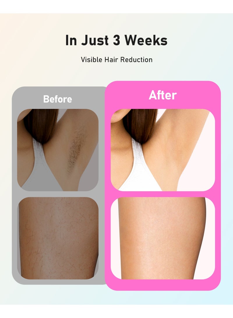 JOOYEE Laser Hair Removal IPL Device 999900 Flashes Dual Flashes Mode 3 Weeks Visible for Women Men Home Laser Quick Safe Treament - Image 4