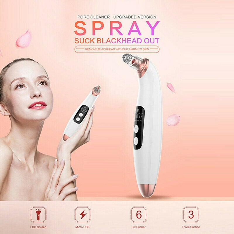 Electric Blackhead Remover Pore Vacuum Suction Face Cleaner Tool with 6 Suckers - Image 5