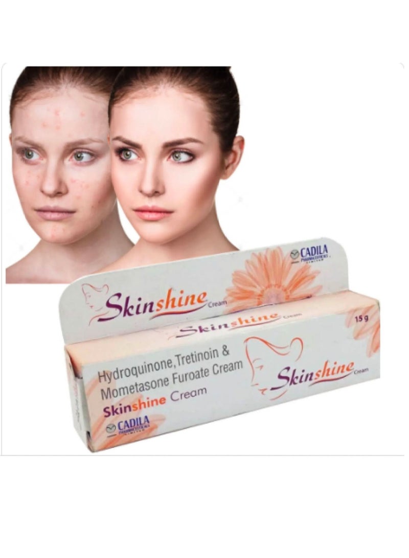 Indian Skin Shine Cream for the treatment of melasma and acne 30 gm