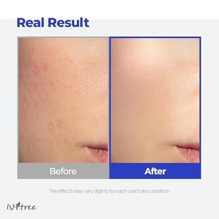 IsNtree Hyaluronic Acid Aqua Gel Cream 100ml, 3.38 fl oz | Korean Skincare | Lightweight Moisturizer | Quick-Absorbing Hydration | For Oily to Combination Skin - Image 5