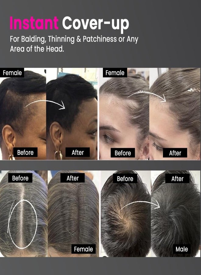 XEWOi Korean Hairline Cover-Up Powder Black 4gm | Instantly Covers Grey Roots, Bald Spots, Beard & White Hair | Matte Finish & Long-Lasting | Highly Pigmented Flawless Hair Density Filler - Image 2
