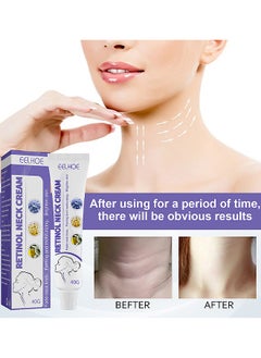 EELHOE Retinol Neck Cream, Fade Neck Lines, Firming And Moisturizing Brighten Skin Neck Massage, Reshape Swan Neck 40G  - Image 1