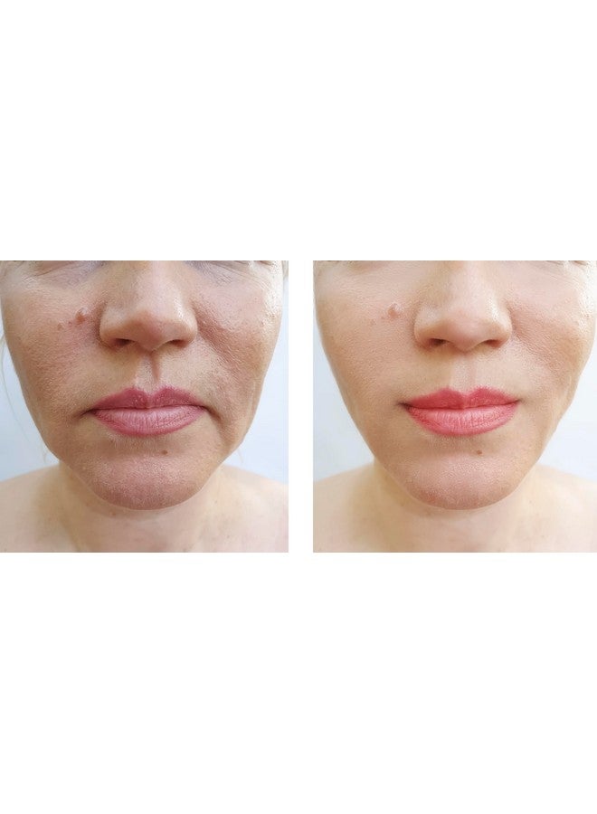 Precision Skin RX Vitality Precision Skin Salicylic Peel Pads 3 Month Supply - Image 3