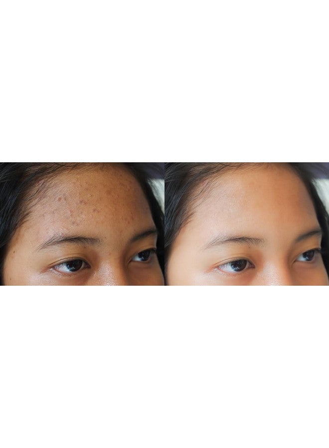 Precision Skin RX Vitality Precision Skin Salicylic Peel Pads 3 Month Supply - Image 4