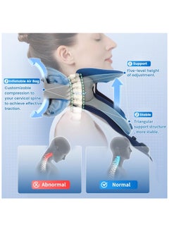 Velpeau Cervical Neck Traction Device Adjustable Neck Support Brace for Men and Women Posture Corrector (Inflatable Version)  - Image 3