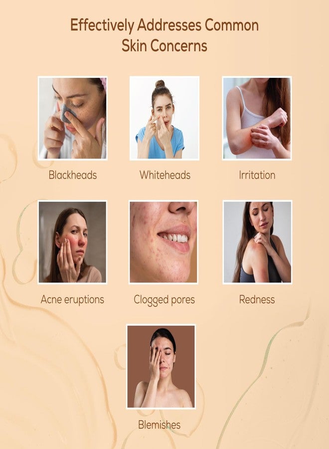 Pil Acneguard Soap | Clears Acne, Pimples, Clogged Pores | For Face And Body | Perfect Blend Of Natural Ingredients | Deeply Cleanses | Gentle | Refreshing (75gm Each, Pack of 3) - Image 5