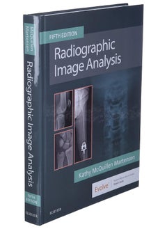 Radiographic Image Analysis - pzsku/ZEA658D19ABAC90BE5C64Z/45/_/1739453245/66d6d55b-fbc1-4ceb-8cf9-46603b10f597