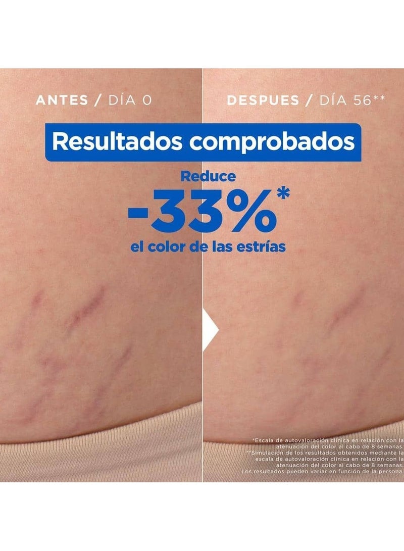 Mixa Anti-Stretch Mark Oil with a Non-Greasy Finish 100ml - Image 2