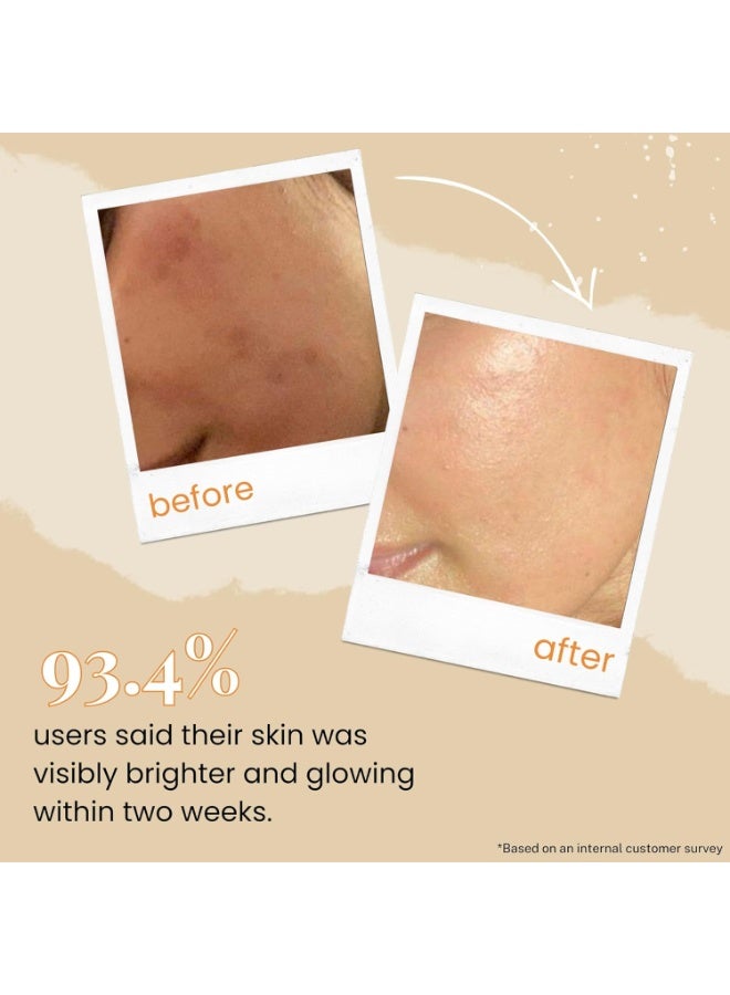 Little Extra Rice Berry 10% Vitamin C Face Serum for Glowing, Bright Skin - Fade Dark Spots, for Dull Skin, Uneven Skin Tone, Non Irritating, All Skin Types, Women and Men, 30ml - Image 4