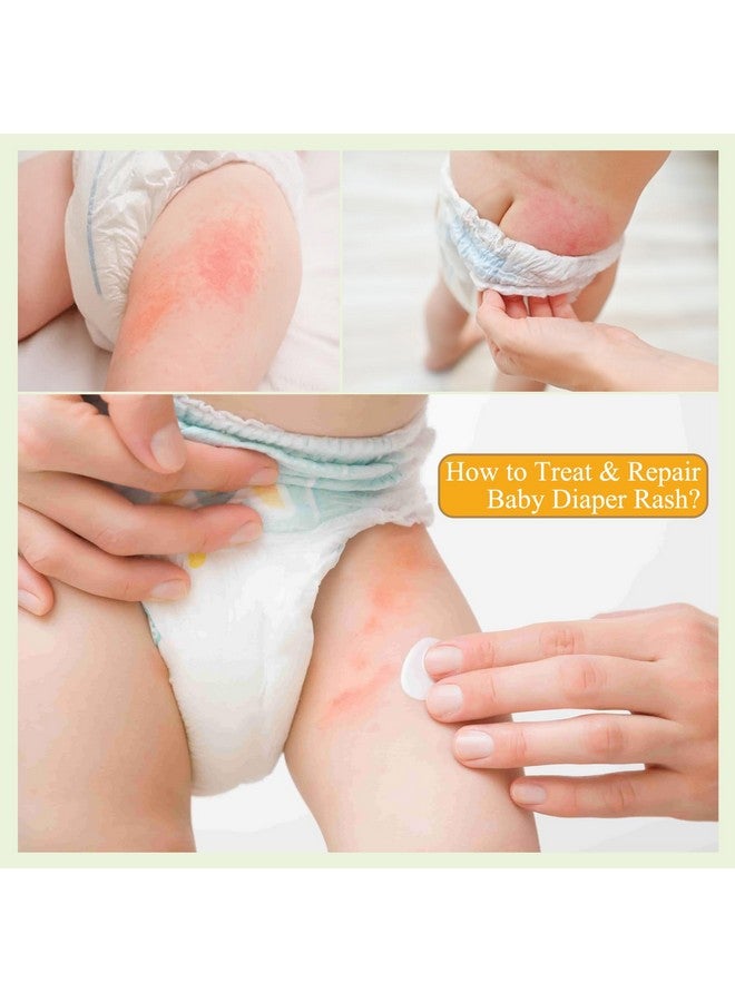 AOAO Diaper Rash Cream for Babies - Pediatrician-Recommended to Prevent, Soothe, and Treat Breakouts Diaper Rash and Flare-Ups, Baby Skin Protectant (100ml, 3.38, Fl Oz) - Image 4