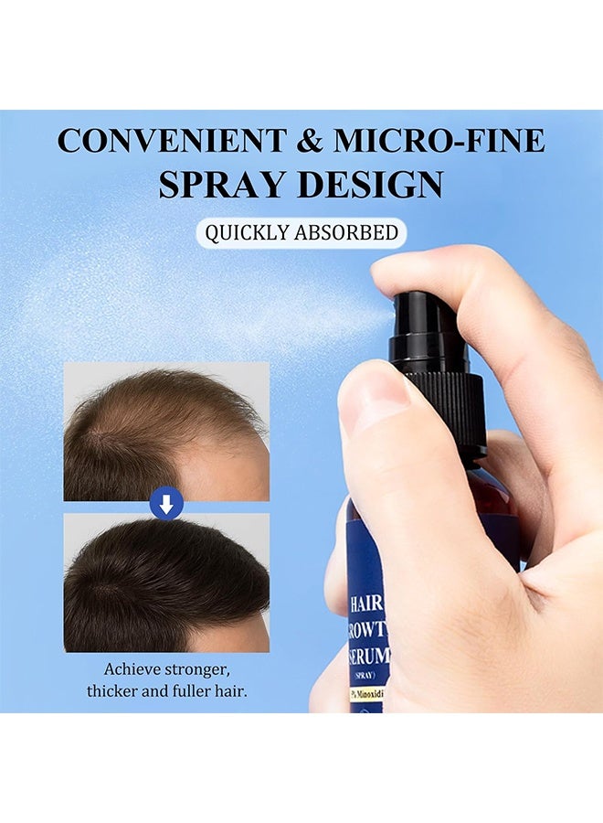 إيلهو بخاخ نمو الشعر مينوكسيديل 5% - مينوكسيديل لنمو الشعر للرجال والنساء، علاج إعادة نمو الشعر لشعر أقوى وأكثر كثافة (60 مل) - Image 5