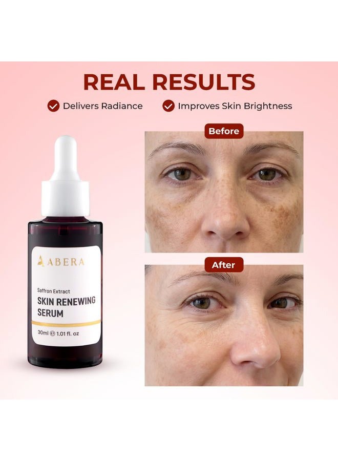 ABERA Skin Renewing Serum for Face, Melasma Treatment, Anti-Aging Serum for Fine Lines & Wrinkles, High Potency Saffron Extract, Hydrating Serum, Dark Spot Remover (1.01 Fl Oz) - Image 4