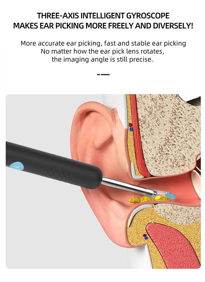 Bebird - R1 Ear Wax Removal Tool wireless Intelligent Visual Otoscope Ear Cleaner High Precision with Earwax Removal Tool - Image 1