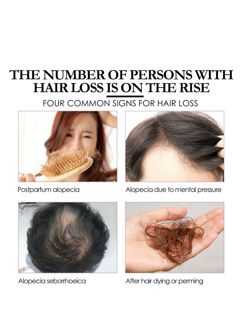 EELHOE - Batana Oil for Hair Growth  Batana Oil - Batana Oil Organic for Healthy Hair - Repair Damaged Hair, Nourishes Thin Hair Scalp Skin and Loss Hair Growth Fir for All Hair Types - 30 ml - Image 1