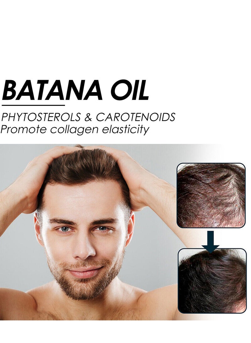 EELHOE - Batana Oil for Hair Growth  Batana Oil - Batana Oil Organic for Healthy Hair - Repair Damaged Hair, Nourishes Thin Hair Scalp Skin and Loss Hair Growth Fir for All Hair Types - 30 ml - Image 1