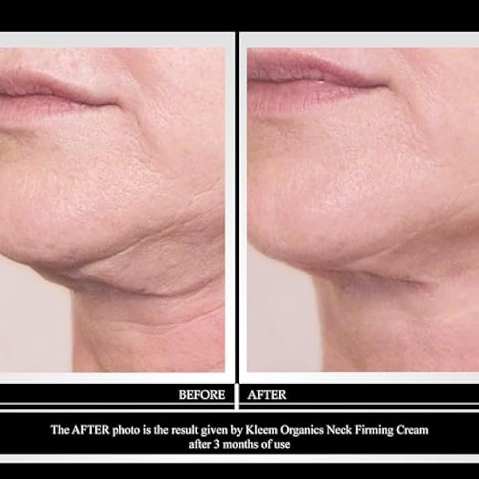 Kleem Organics Kleem Neck Firming Cream | Retinol Moisturizer for Face & Décolleté | Anti Aging Cream for Women | Smooth Fine Lines, Wrinkles & Crepey Skin | Hydrating Collagen & Peptides | Made in USA | 1.7 oz - Image 2
