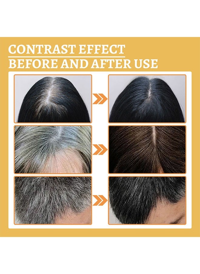 Anti-Greying Hair Serum, Dark Anti Graying Hair Serum For Men and Women, Ganoderma Nutrient Natural Darkening, Promoting Healthier And Thicker Hair