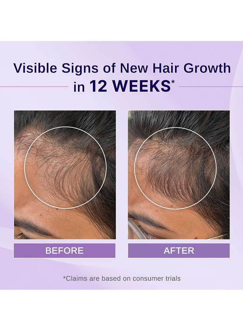 Bare Anatomy Nature x Science Rosemary Hibiscus Hair Growth Oil for Women & Men | Promotes New Hair Growth & Strengthens Hair | Nourishes Scalp & Controls Hair Fall -100ml - Image 2